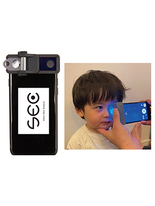 Smart Eye Camera
